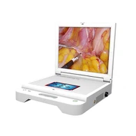 휴대용 HD 디스플레이 엔트 내시경 카메라